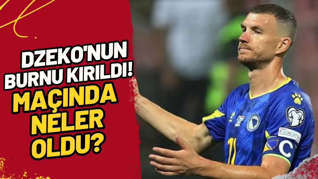 Dzeko'nun Burnu Kırıldı! Romanya Maçında Neler Oldu?